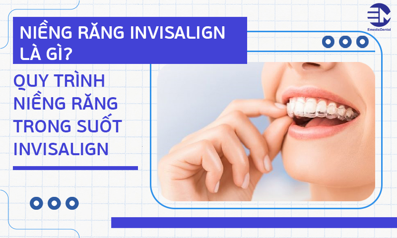 niềng răng invisalign