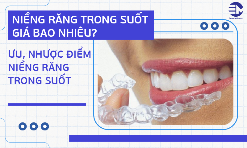 niềng răng trong suốt