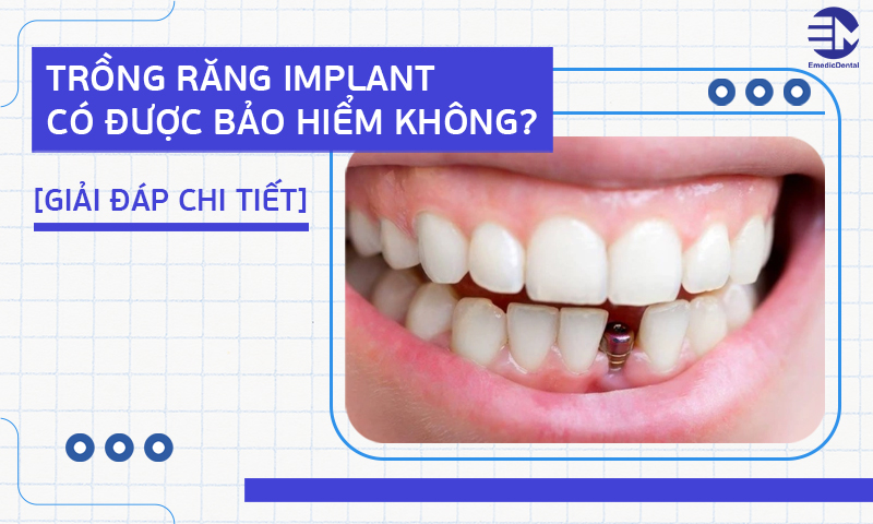 Trồng răng implant có được bảo hiểm không