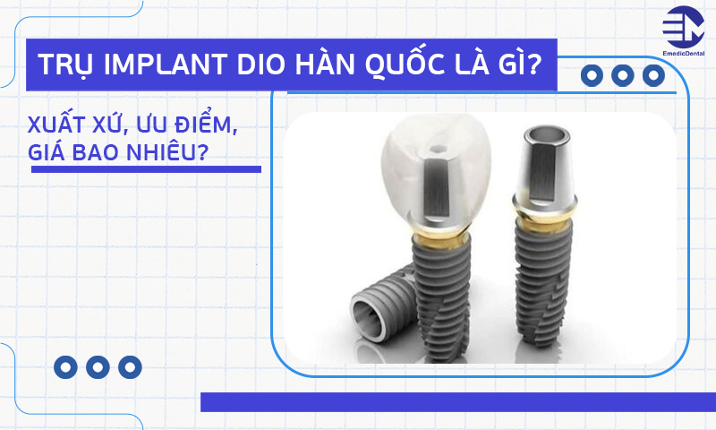 Trụ Implant DIO