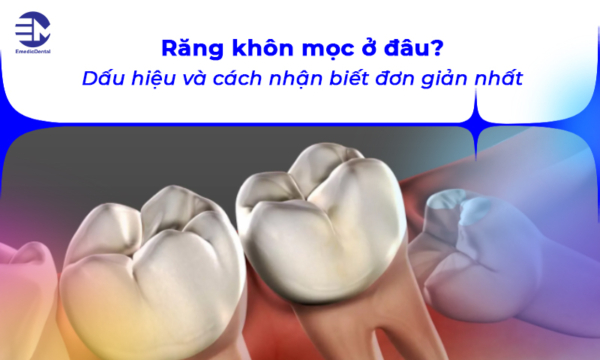 Răng khôn mọc ở đâu? Dấu hiệu và cách nhận biết đơn giản