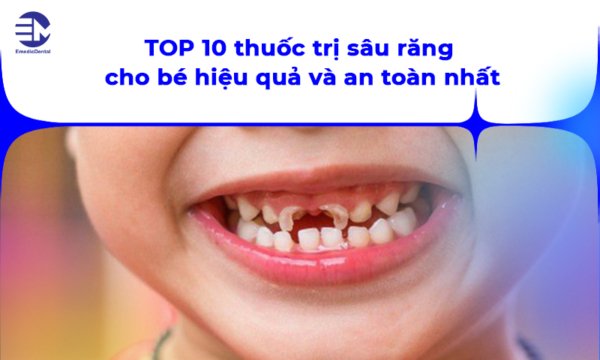 TOP 10 thuốc trị sâu răng cho bé hiệu quả và an toàn nhất