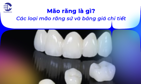 Mão răng là gì? Các loại mão răng sứ và bảng giá chi tiết