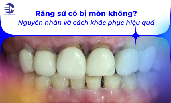 Răng sứ có bị mòn không: nguyên nhân và cách khắc phục hiệu quả