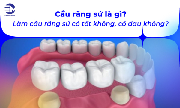 Cầu răng sứ là gì? Làm cầu răng sứ có tốt không, có đau không?
