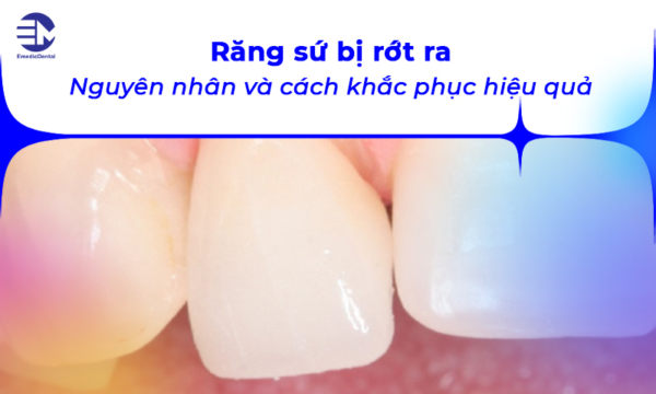 Răng sứ bị rớt ra: nguyên nhân và cách khắc phục hiệu quả