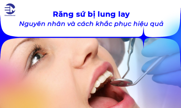 Răng sứ bị lung lay: Nguyên nhân và cách khắc phục hiệu quả