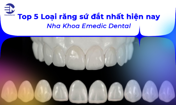 Top 5 Loại răng sứ đắt nhất hiện nay - Nha Khoa Emedic Dental