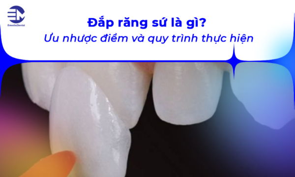 Đắp răng sứ là gì? Ưu nhược điểm và quy trình thực hiện