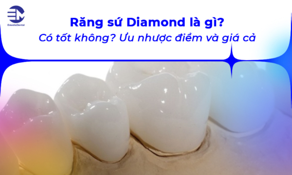 Răng sứ Diamond là gì? Có tốt không? Ưu nhược điểm và giá cả