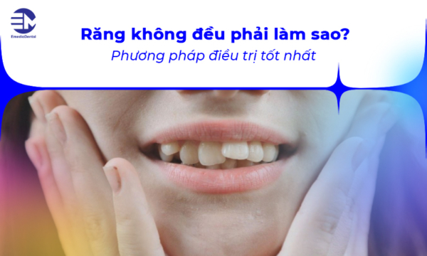 Răng không đều phải làm sao? Phương pháp điều trị tốt nhất