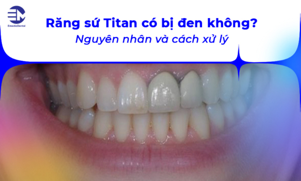 Răng sứ Titan có bị đen không? Nguyên nhân và cách xử lý