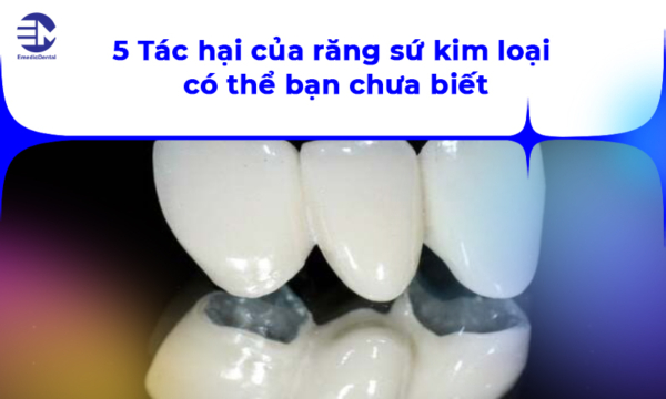 5 Tác hại của răng sứ kim loại có thể bạn chưa biết