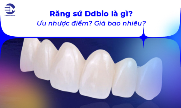 Răng sứ Ddbio là gì? Ưu nhược điểm? Giá bao nhiêu?