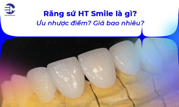 Răng sứ HT Smile là gì? Ưu nhược điểm? Giá bao nhiêu?