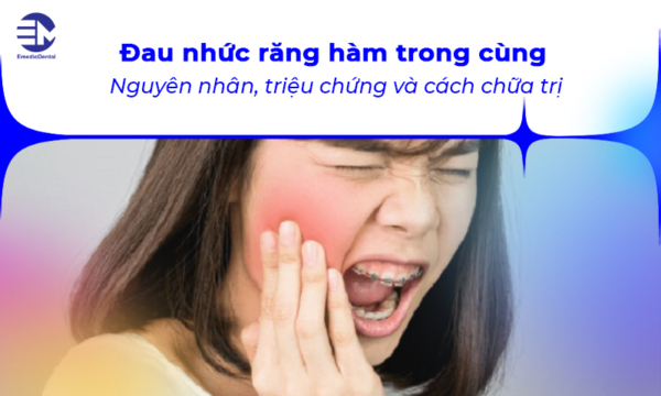 Đau nhức răng hàm trong cùng điều trị như thế nào?