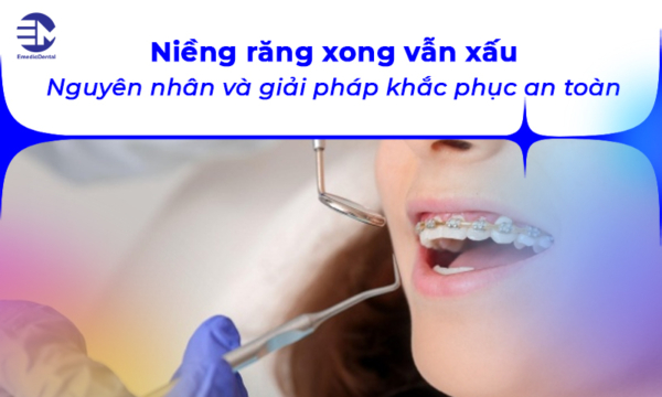 Niềng răng xong vẫn xấu: Nguyên nhân và giải pháp khắc phục an toàn