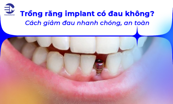 Trồng răng implant có đau không? Cách giảm đau nhanh chóng, an toàn