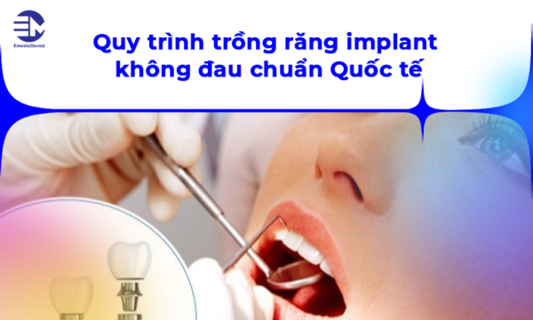 Quy trình trồng răng implant không đau chuẩn Quốc tế