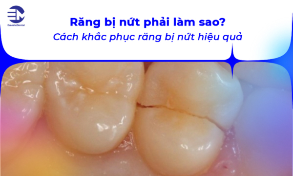 Răng bị nứt phải làm sao? Cách khắc phục răng bị nứt