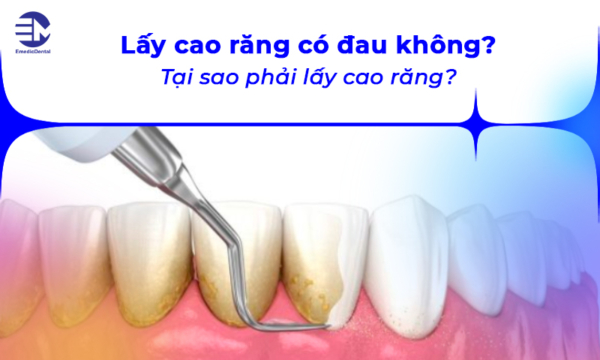 Lấy cao răng có đau không