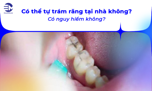 Có thể tự trám răng tại nhà không? Có nguy hiểm không?