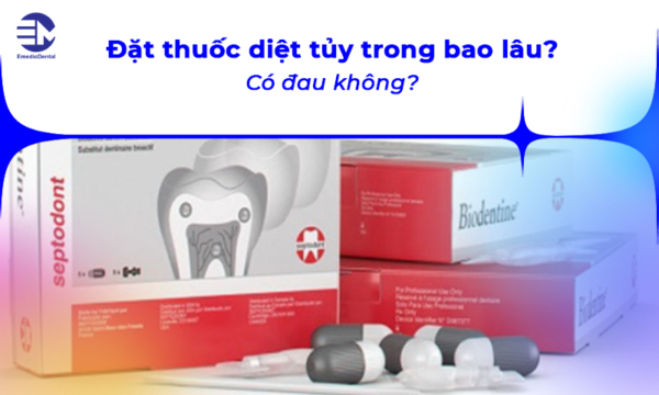 Đặt thuốc diệt tủy răng trong bao lâu? Có đau không?