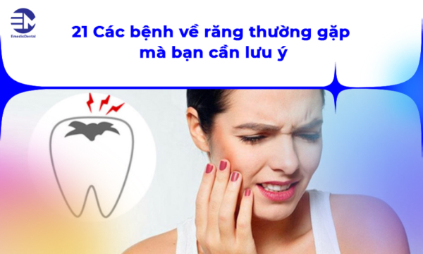 21 các bệnh về răng thường gặp mà bạn cần lưu ý