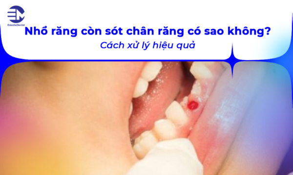 Nhổ răng còn sót chân răng có sao không? Cách xử lý hiệu quả