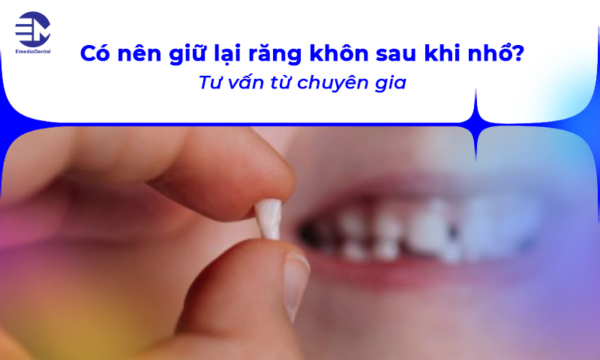 Có nên giữ lại răng khôn sau khi nhổ? Tư vấn từ chuyên gia