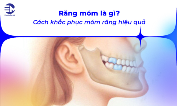 Răng móm là gì? Cách khắc phục móm răng hiệu quả