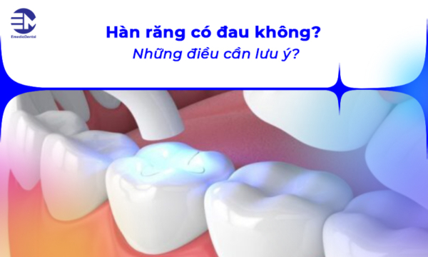 Hàn răng có đau không? Những điều cần lưu ý?