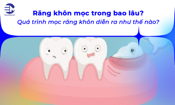 Răng khôn mọc trong bao lâu? Cần phải làm gì?