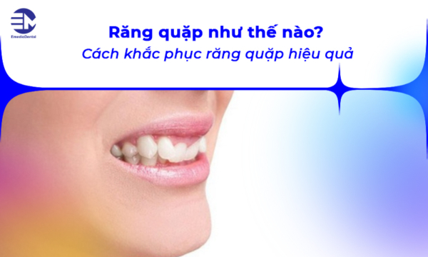 Răng quặp như thế nào? Cách khắc phục răng quặp hiệu quả