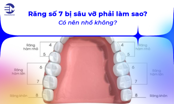 Răng số 7 bị sâu vỡ phải làm sao? có nên nhổ không?