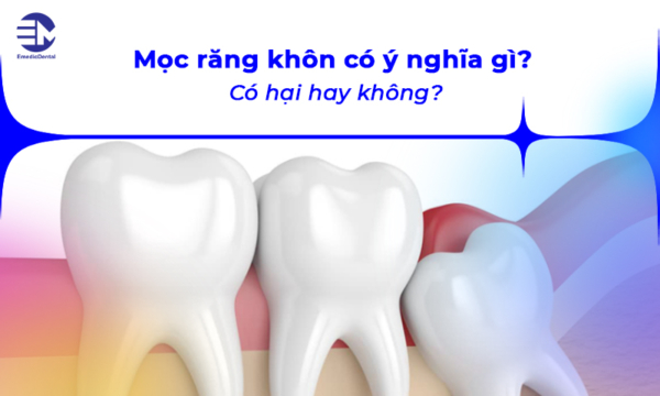 Mọc răng khôn có ý nghĩa gì? Có hại hay không?