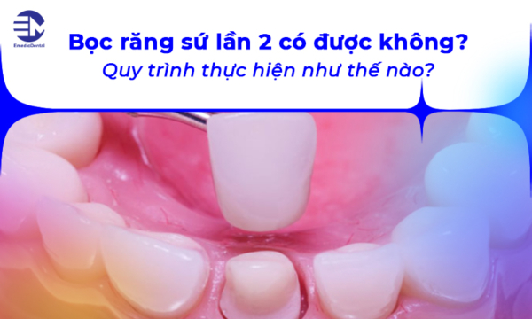 Bọc răng sứ lần 2 có được không? Quy trình thực hiện như thế nào?