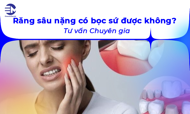 Răng sâu nặng có bọc sứ được không