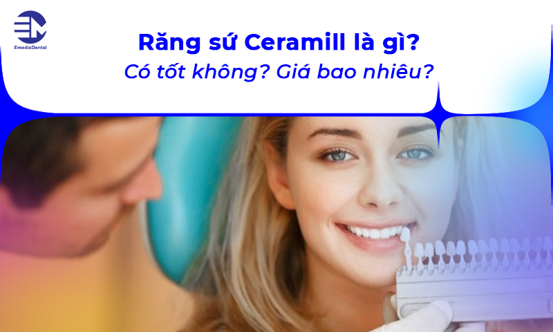 Răng sứ Ceramill