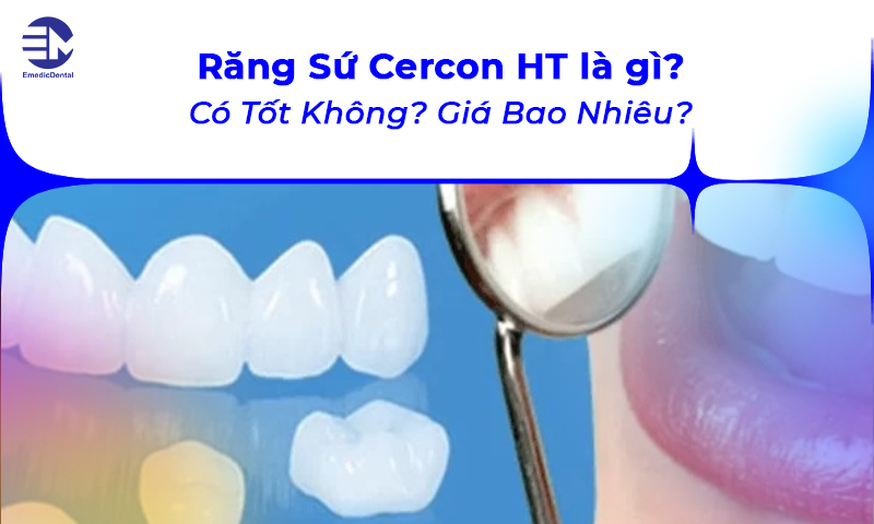 răng sứ cercon