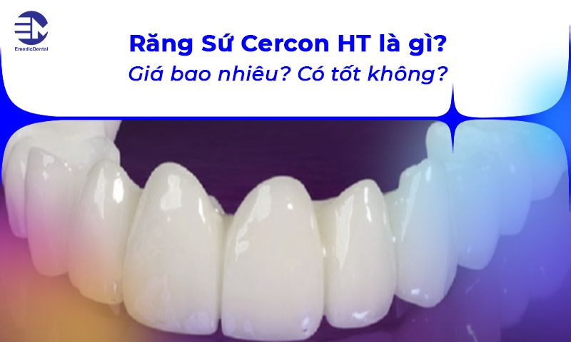 Răng sứ Cercon HT