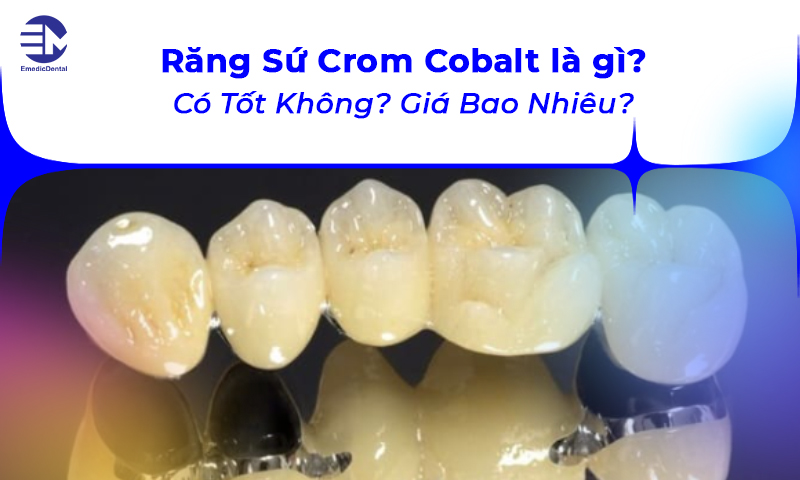 Răng Sứ Crom Cobalt