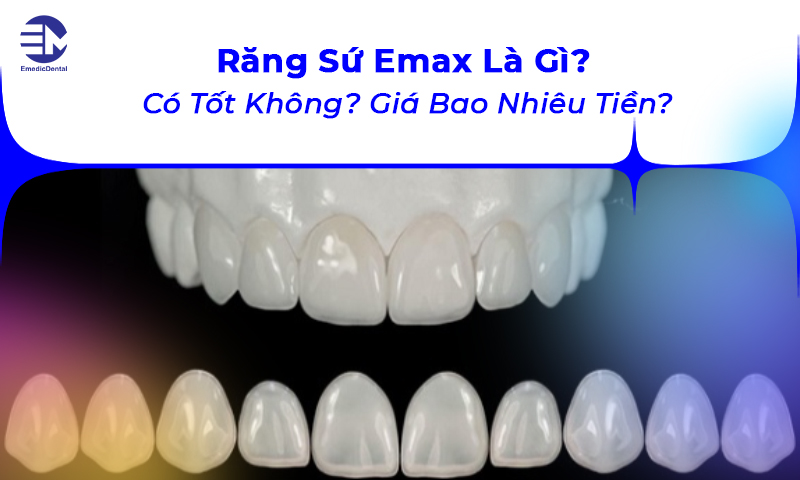 răng sứ emax