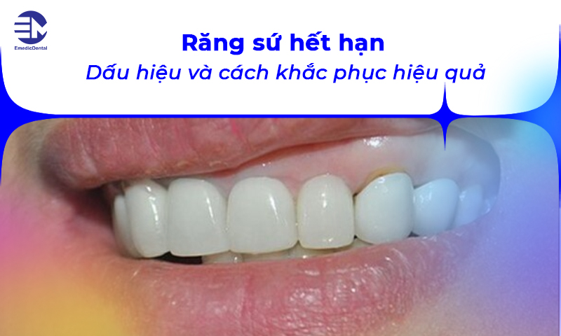 răng sứ hết hạn