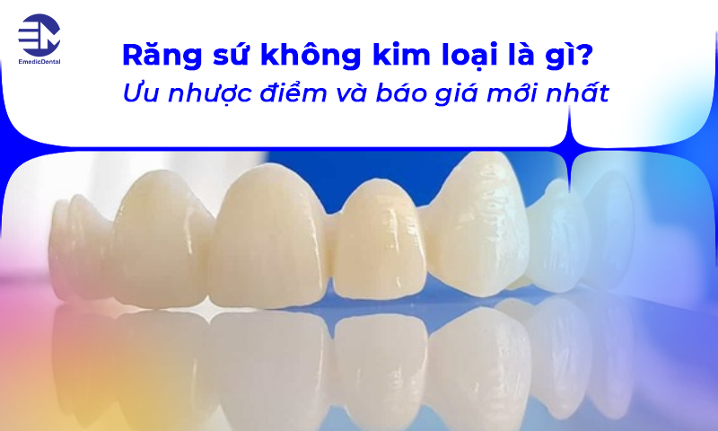 Răng sứ không kim loại là gì