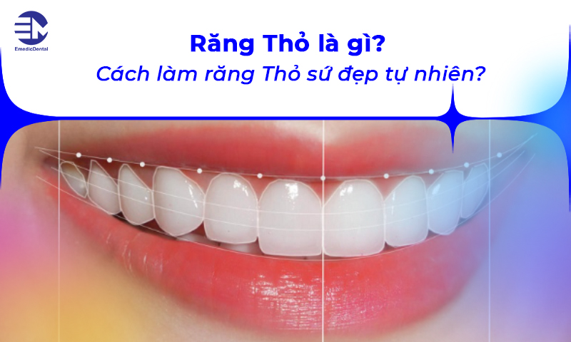 Răng Thỏ