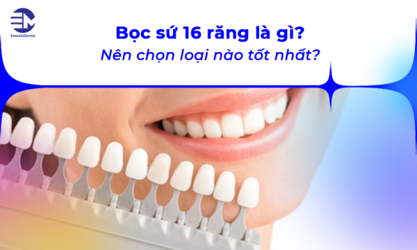 Bọc sứ 16 răng là gì? Nên chọn loại nào tốt nhất?