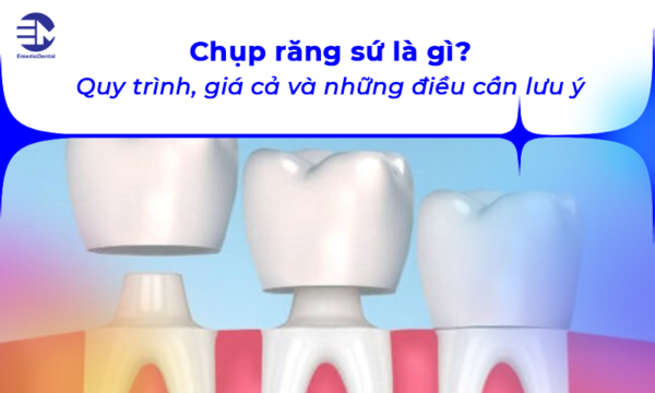 Chụp răng sứ là gì? Quy trình, giá cả và những điều cần lưu ý