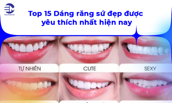 Top 15 Dáng răng sứ đẹp được yêu thích nhất hiện nay