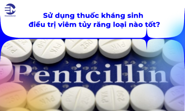 Sử dụng thuốc kháng sinh điều trị viêm tủy răng loại nào tốt?